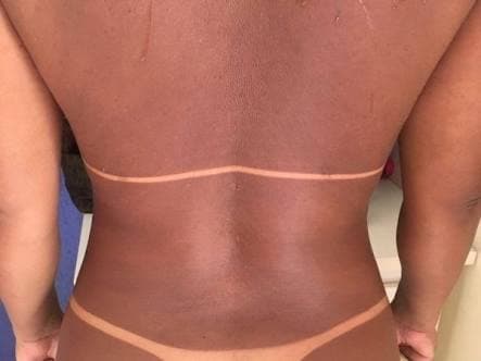 Efeito Visível na Forma do Corpo